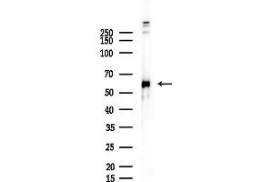 anti-Dihydroxyacetone Kinase 2 Homolog (DAK) (Internal Region) antibody