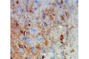 Used in DAB staining on fromalin fixed paraffin-embedded Brain tissue (RNLS antibody  (AA 18-150))