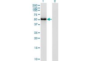 Western Blot analysis of FLI1 expression in transfected 293T cell line by FLI1 monoclonal antibody (M02), clone 2G8. (FLI1 antibody  (AA 1-452))