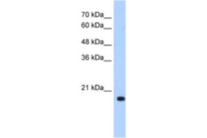 Western Blotting (WB) image for anti-DCTP Pyrophosphatase 1 (DCTPP1) antibody (ABIN2462971) (DCTPP1 antibody)