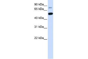WB Suggested Anti-SMARCD1 Antibody Titration: 0. (SMARCD1 antibody  (Middle Region))