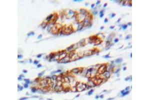 Used in DAB staining on fromalin fixed paraffin-embedded Stomach tissue (Connexin 31 antibody  (AA 211-269))