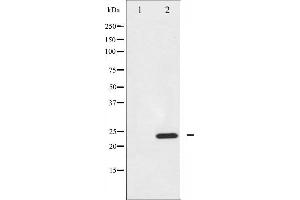 Western blot analysis of BIK expression in A549 whole cell lysates,The lane on the left is treated with the antigen-specific peptide. (BIK antibody)