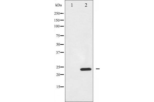 BIK antibody