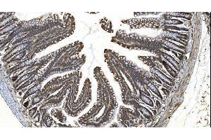 IHC analysis of YTHDF2 using anti-YTHDF2 antibody (ABIN7603191). (YTHDF2 antibody  (N-Term))