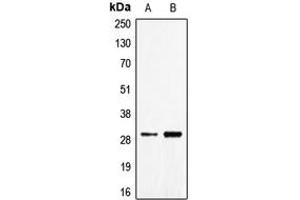 Western blot analysis of CD70 expression in Jurkat (A), NCIH460 (B) whole cell lysates.