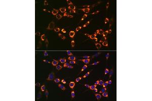 Immunofluorescence analysis of NIH-3T3 cells using PBR/TSPORabbit mAb (ABIN1679051, ABIN3019258, ABIN3019259 and ABIN7101738) at dilution of 1:100 (40x lens). (TSPO antibody)