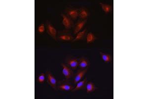 Immunofluorescence analysis of U2OS cells using  Rabbit pAb (ABIN3020671, ABIN3020672, ABIN1512605 and ABIN6213659) at dilution of 1:100 (40x lens). (ATF6 antibody  (AA 1-190))