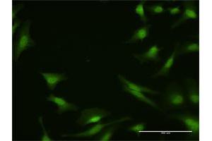 Immunofluorescence (IF) image for anti-Protein Phosphatase 2A Activator, Regulatory Subunit 4 (PPP2R4) (AA 1-323) antibody (ABIN519124)
