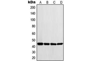 Western blot analysis of LYAR expression in K562 (A), Ramos (B), HeLa (C), A431 (D) whole cell lysates. (LYAR antibody  (Center))