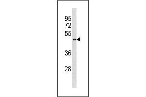 BCL6B Antibody (Center) (ABIN1881109 and ABIN2843280) western blot analysis in A549 cell line lysates (35 μg/lane). (BCL6B antibody  (AA 276-302))