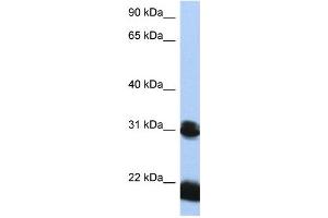 WB Suggested Anti-OTX1 Antibody Titration:  0. (OTX1 antibody  (N-Term))