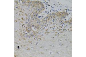 Immunohistochemistry of paraffin-embedded human esophagus using IRF1 antibody (ABIN5995375) (40x lens). (IRF1 antibody)