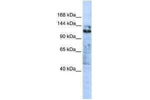 WB Suggested Anti-ZNF451 Antibody Titration:  0. (ZNF451 antibody  (C-Term))