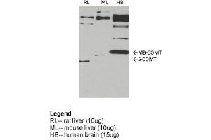 COMT antibody - middle region  validated by WB using rat liver, mouse lung, human brain at 1:1000. (COMT antibody  (Middle Region))
