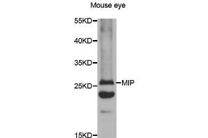 Western blot analysis of extracts of mouse eyes tissue lysate, using MIP antibody. (MIP antibody)