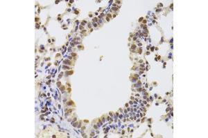 Immunohistochemistry of paraffin-embedded mouse lung using AAAS Antibody.