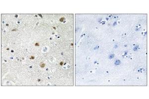 Immunohistochemistry analysis of paraffin-embedded human brain tissue using TF3B antibody.