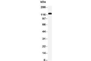 Western blot testing of NKCC2 antibody and rat kidney tissue lysate. (SLC12A1 antibody  (N-Term))