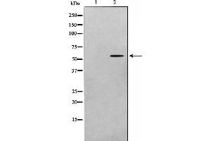 Western blot analysis on A549 cell lysate using ADCK1 Antibody,The lane on the left is treated with the antigen-specific peptide. (ADCK1 antibody  (Internal Region))