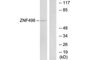 Western blot analysis of extracts from COS7 cells, using ZNF498 Antibody. (Zinc Finger and SCAN Domain Containing 25 (ZSCAN25) (AA 331-380) antibody)