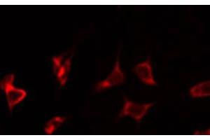 ABIN6266823 staining HeLa by IF/ICC. (TUSC2 antibody  (Internal Region))