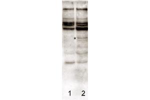 Immunoblotting. (Caspase 2 antibody  (N-Term))