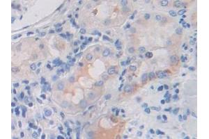 Immunohistochemistry (IHC) image for anti-Fibroblast Growth Factor Receptor 3 (FGFR3) (AA 166-375) antibody (ABIN7434086)