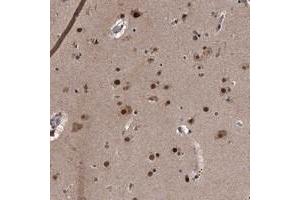 Immunohistochemical staining of human cerebral cortex with ZNF518B polyclonal antibody  shows strong nuclear positivity in neuronal and glial cells.