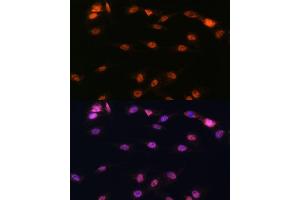 Immunofluorescence analysis of C6 cells using  antibody (ABIN3023072, ABIN3023073, ABIN3023074 and ABIN6219376) at dilution of 1:100. (ALOX5 antibody  (AA 1-300))