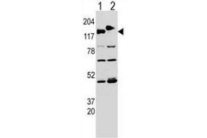 Western blot analysis of CLASP (arrow) using rabbit polyclonal CLASP Antibody (pTyr1019) .