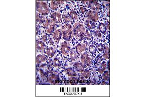 ANKRD22 Antibody immunohistochemistry analysis in formalin fixed and paraffin embedded human stomach tissue followed by peroxidase conjugation of the secondary antibody and DAB staining. (ANKRD22 antibody  (C-Term))