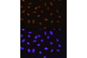 Immunofluorescence (IF) image for anti-Small Ubiquitin Related Modifier Protein 1 (SUMO1) antibody (ABIN7270373)