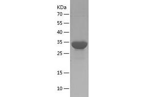 Western Blotting (WB) image for S100 Calcium Binding Protein A9 (S100A9) (AA 1-114) protein (His-IF2DI Tag) (ABIN7283537) (S100A9 Protein (AA 1-114) (His-IF2DI Tag))