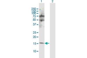 Western Blot analysis of NUDT2 expression in transfected 293T cell line by NUDT2 MaxPab polyclonal antibody.