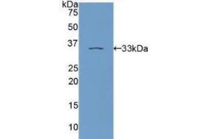 Western blot analysis of recombinant Human PKCe. (PKC epsilon antibody  (AA 403-672))