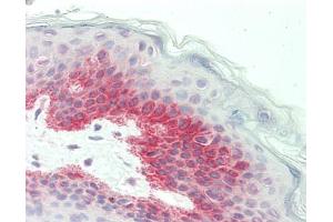 Human Skin: Formalin-Fixed, Paraffin-Embedded (FFPE). (GFPT2 antibody  (AA 611-660))