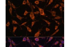 Immunofluorescence analysis of L929 cells using FBLN5 Polyclonal Antibody at dilution of 1:100 (40x lens). (Fibulin 5 antibody)