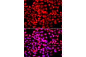 Immunofluorescence analysis of A549 cells using TDP1 antibody (ABIN5975735). (TDP1 antibody)