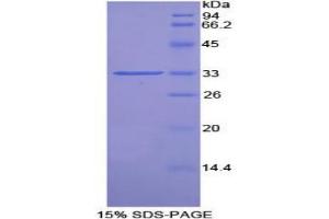 SDS-PAGE analysis of Rat Pim-2 Oncogene Protein. (PIM2 Protein)