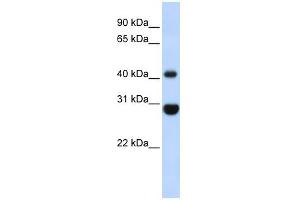 CNP antibody used at 1 ug/ml to detect target protein.