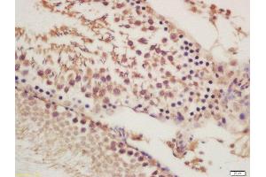 Formalin-fixed and paraffin embedded rat testies labeled with Rabbit Anti-ORP1 Polyclonal Antibody, Unconjugated (ABIN2178099) at 1:200 followed by conjugation to the secondary antibody and DAB staining (OSBPL1A antibody  (AA 851-950))
