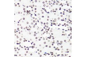 Immunohistochemistry of paraffin-embedded mouse kidney using MonoMethyl-Histone H3-R17 antibody (ABIN3017467, ABIN3017468, ABIN3017469 and ABIN6220100) at dilution of 1:100 (40x lens). (Histone 3 antibody  (H3R17me))