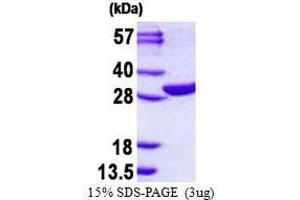 EMG1 Nucleolar Protein Homolog (EMG1) protein (His tag)