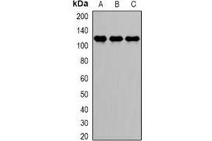 Western blot analysis of DDX58 expression in Jurkat (A), HepG2 (B), MCF7 (C) whole cell lysates. (DDX58 antibody)