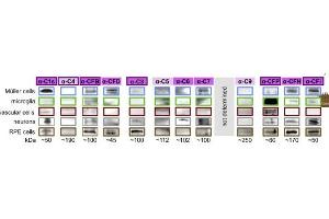 Expression levels of indicated complement components were determined from cells of albino mice at mRNA (bars, 8-week-old mice) and at protein level (western blot, 8- to 24-week -old mice). (Complement Component C9b (C9b) (AA 251-350) antibody)