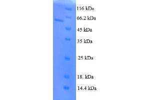 SDS-PAGE (SDS) image for Pituitary Homeobox 3 (PITX3) (AA 1-302), (full length) protein (GST tag) (ABIN4976758)