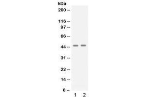 Western blot testing of 1) human A431 and 2) human Jurkat cell lysate with APOBEC3G antibody at 0.