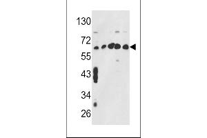 Western blot analysis of CCT3 Antibody (Center) (ABIN389422 and ABIN2839505) in MCF7,CEM,K562,HL-60,Hela cell line lysates (35 μg/lane).