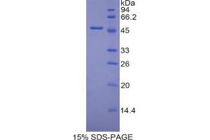 SDS-PAGE analysis of Mouse PECAM1 Protein. (CD31 Protein)